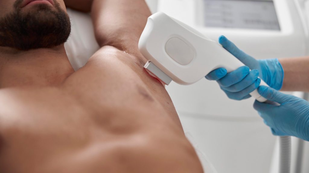 Épilation laser pour homme : comment préparer sa première séance ?